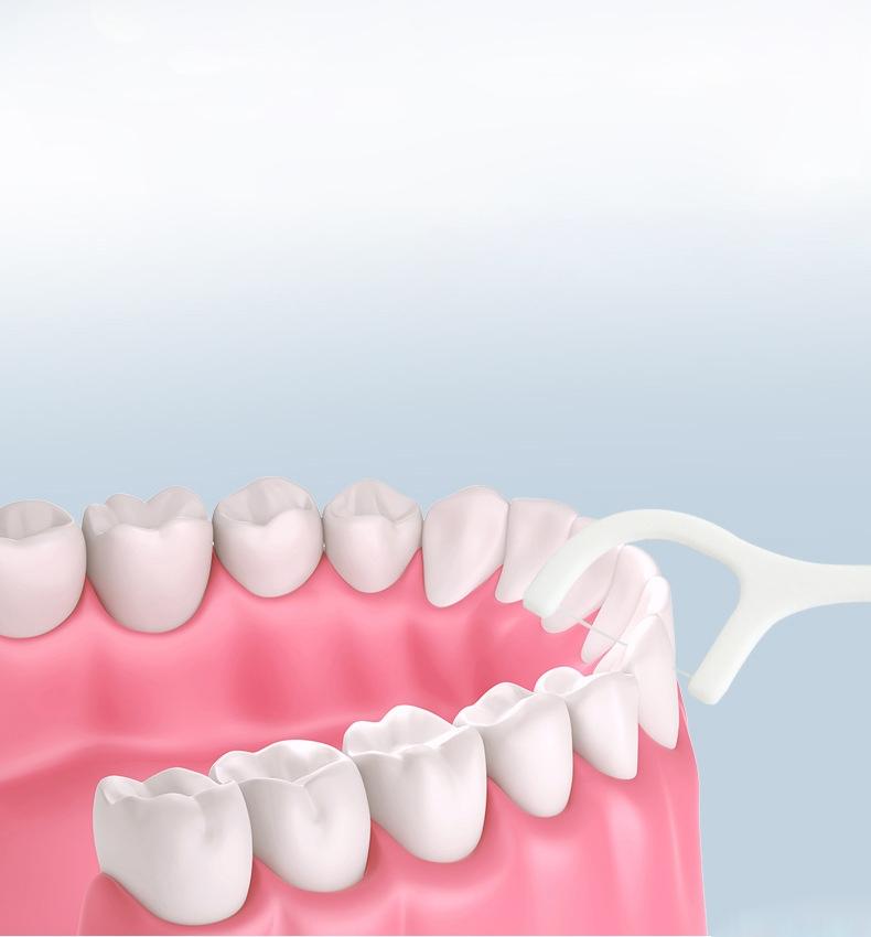 Tandtrådsbågar 100-pack – Stark Tråd för Renare Tänder